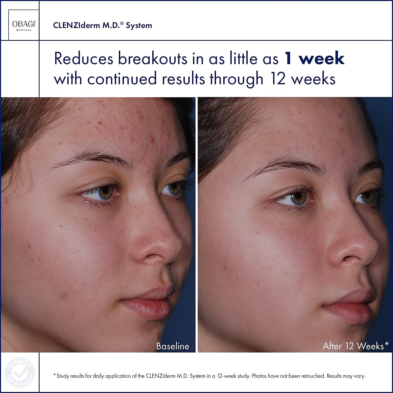 Obagi | CLENZIderm M.D. Acne Therapeutic System